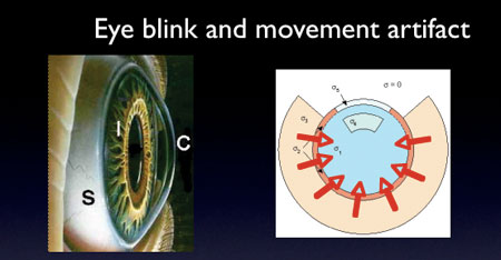 Eye blink diagram.