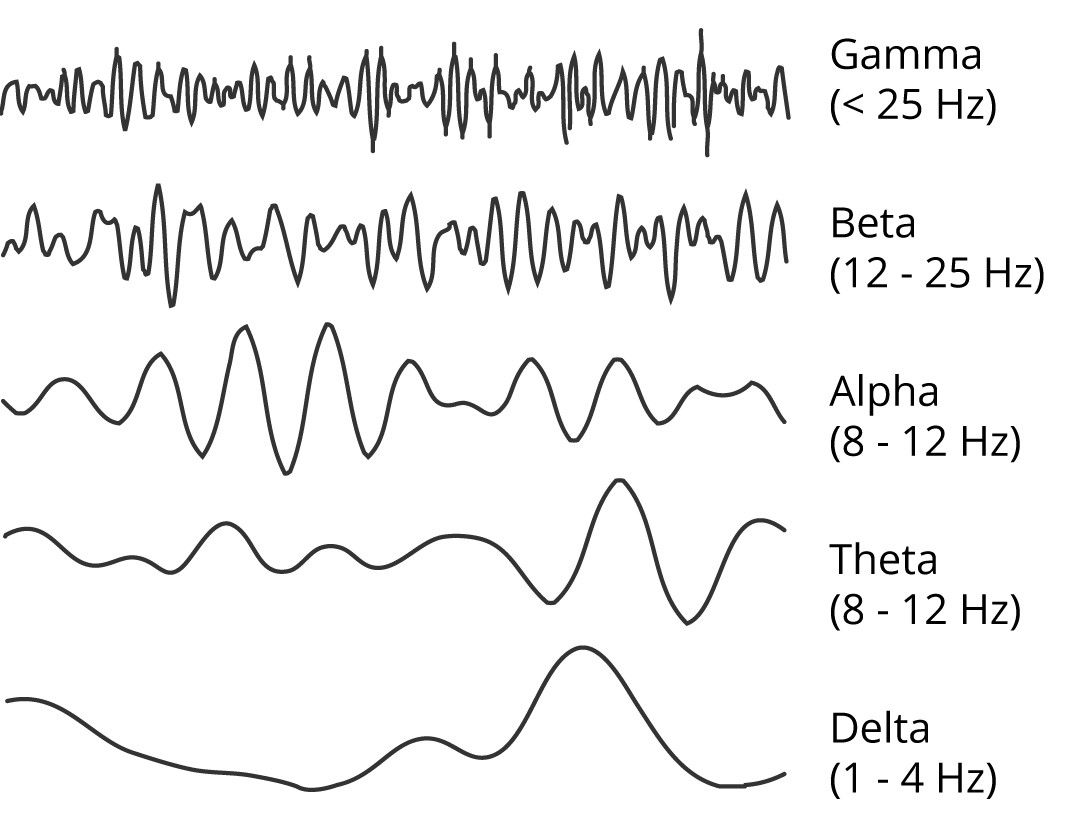 An image illustrating the key frequency ranges of EEG activity.