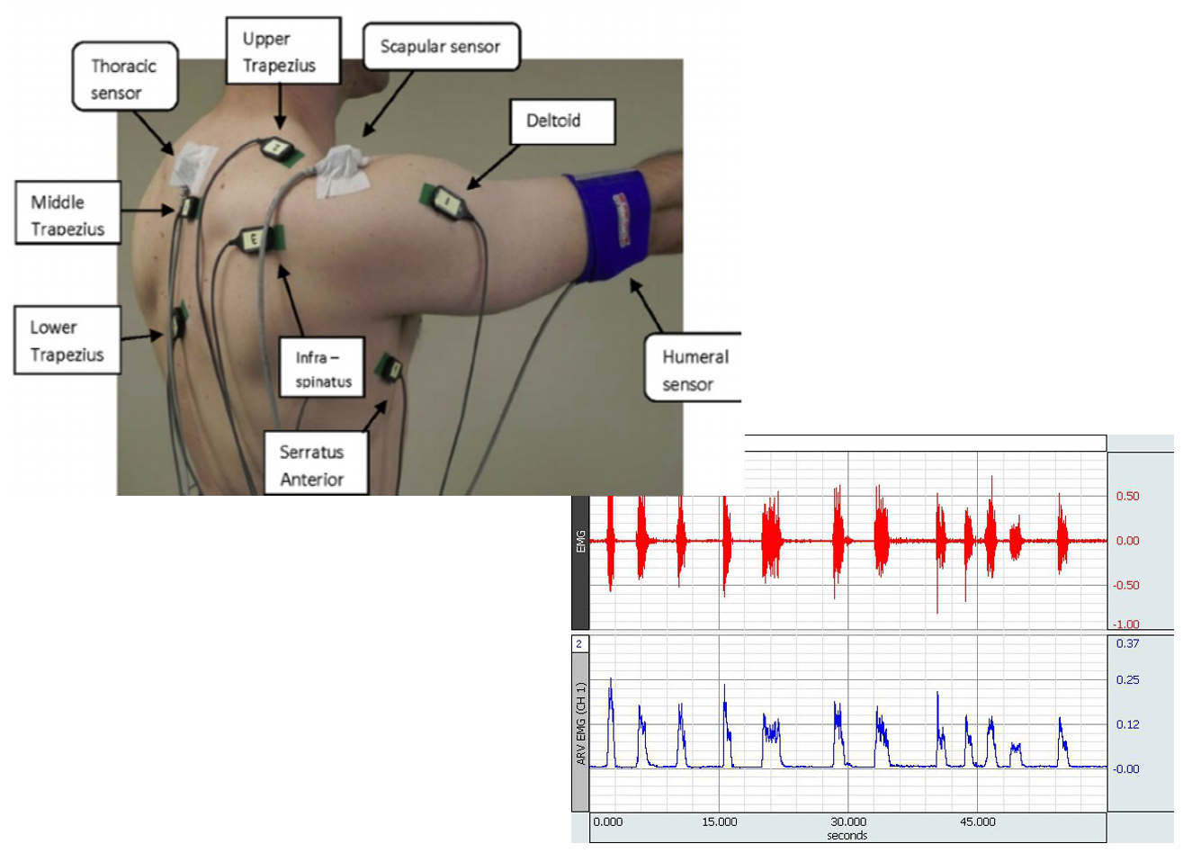 An image illustrating specific EMG electrode locations on an adult human male.