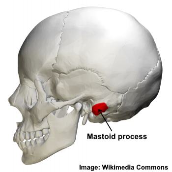 An image of a human skull with the mastoid process highlighted in red.
